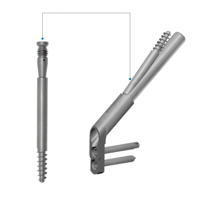 FNS – Antirotation Leg Screw